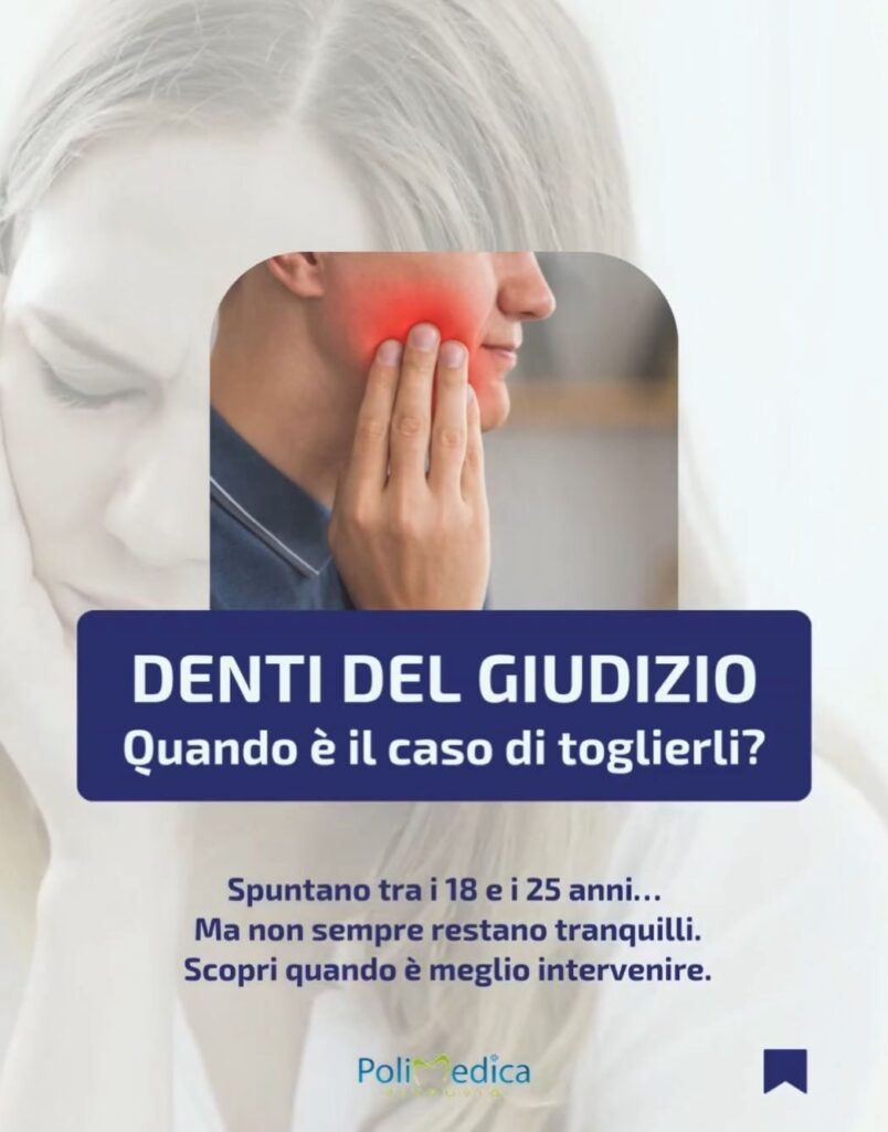 Quando togliere il dente del giudizio