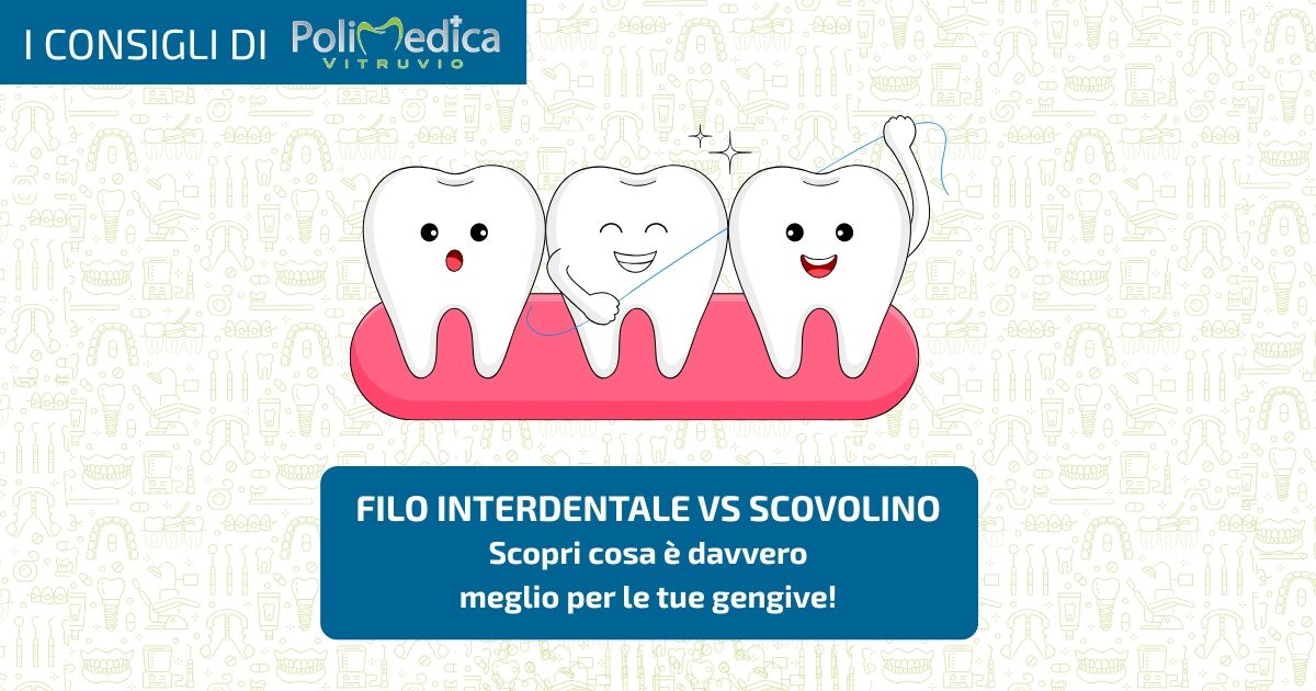 filo interdentale o scovolino