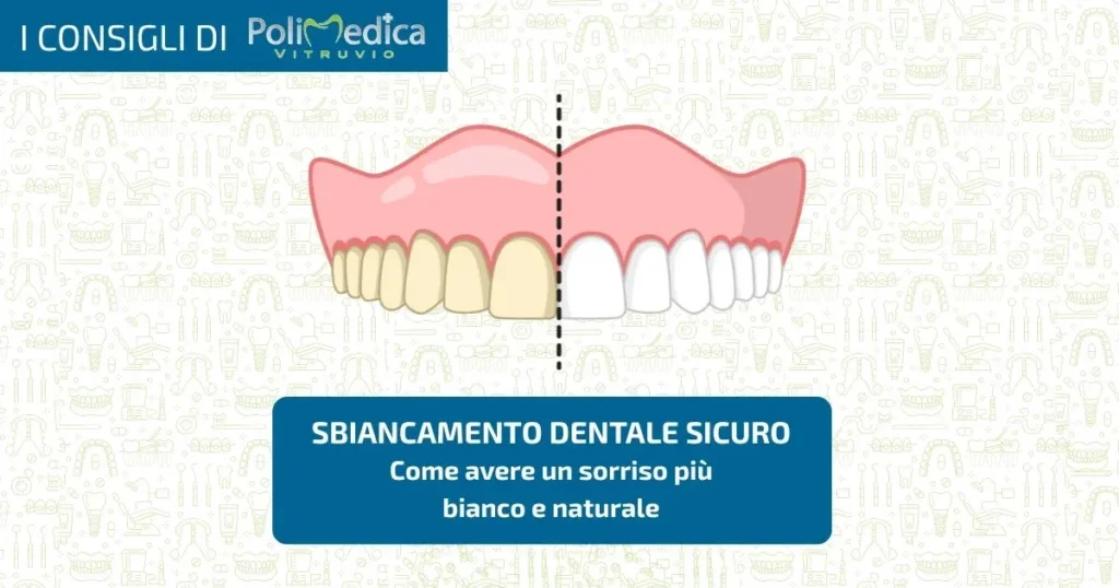 sbiancamento dentale polimedica vitruvio