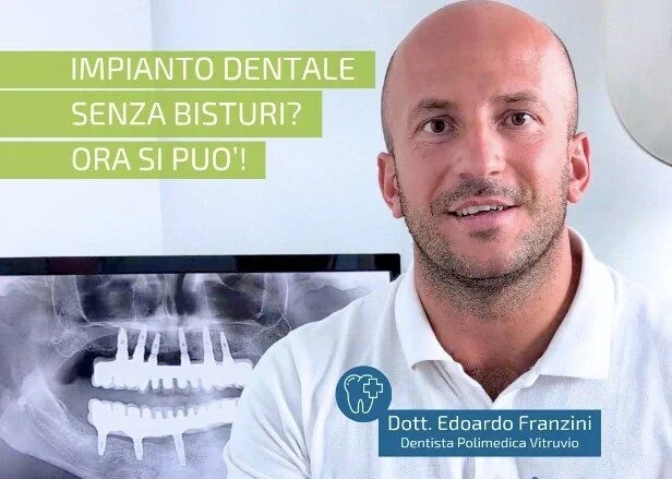 Impianto dentale senza bisturi